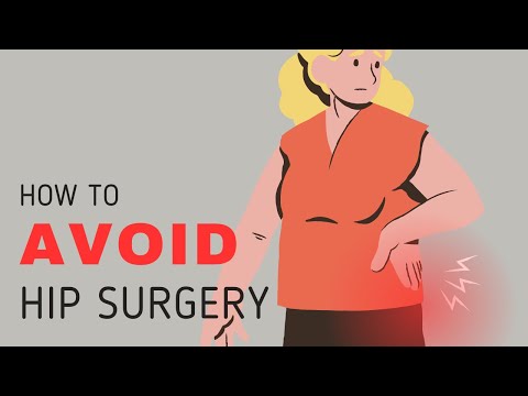 How to Treat Hip Arthritis and Avoid Hip Surgery!
