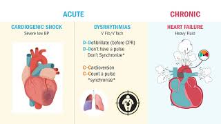 MI | Complications (Heart Failure & V Tach)
