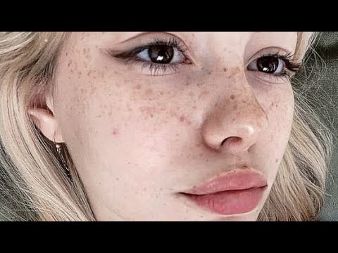 Subliminal para ter lindas sardas