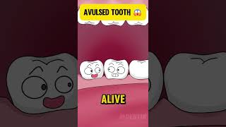 Avulsed Tooth Emergency  Here's What You Need to Know! tooth animation