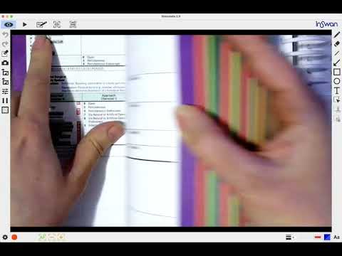 ICD-10-PCS Medical and Surgical Section Root Operations