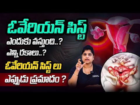 What size of OVARIAN CYST is DANGEROUS ? | types of ovarian cyst telugu | Dr. Moolya Sai |Unihealth
