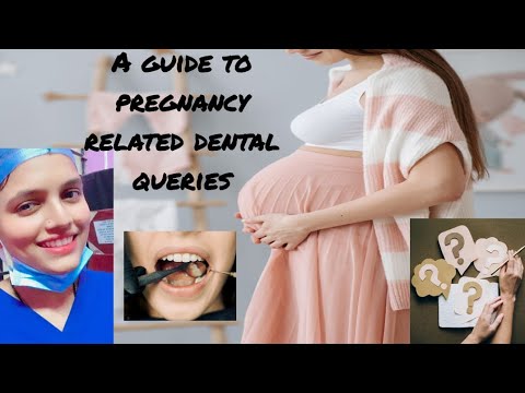 Pregnancy related dental queries part 1