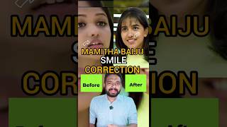 mitra baiju smile correction #arogyam #dentalcare #dentalclinic