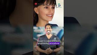 Can I increase the size of the tooth? - Crown lengthening procedure | Dr.Karthikeyan | Denta Kings