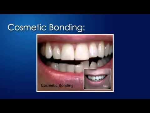 Spearfish Cosmetic Dentist