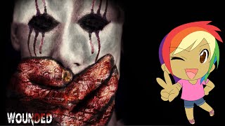 ABSOLUTELY HORRIFYING!! | Wounded
