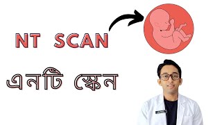 এন টি স্কেন - NT scan - First Trimester Ultrasonography