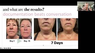 TrueScience Liquid Collagen  - Real World Results