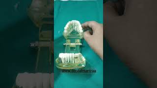 DENTAL instruments #dentist #dentalartistry #dentalinstruments #ytshorts #yt #dentalprosthesis