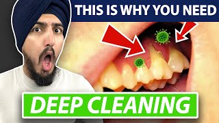 Teeth Cleaning vs Deep Cleaning | Dentist Explains How Teeth Are Cleaned