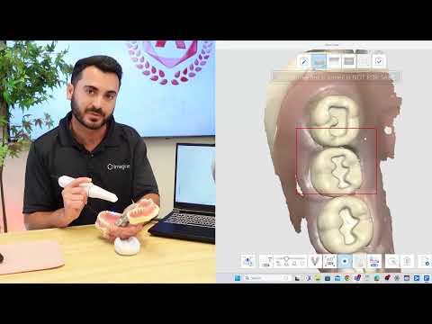 Medit i900 Intraoral Scanner | Scanning Tips