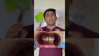Transforming a Dead Tooth  Single Tooth Discolouration Corrected with Internal Bleaching