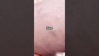 "The Real Reason Blood Looks Blue! 🩸 Myth vs Science in 30 Seconds!"