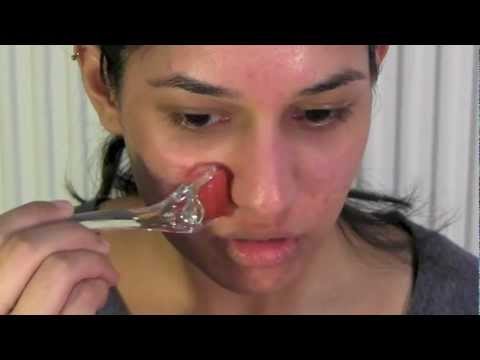 How to Use a Derma Roller for Acne Scars | Micro Needling