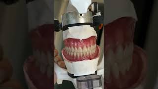 Perfect smile 😁. Smile creation art in prosthodontics. #shorts #viral #trending #bds #smile #dentist