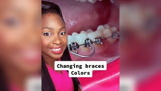 Does changing braces colors hurt? #hygienist #braces