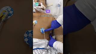 12-Lead EKG Placement