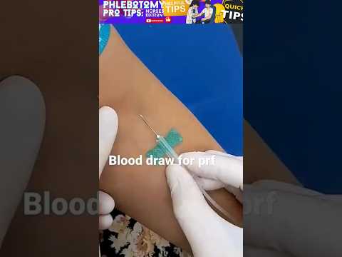 Blood Draw Mistakes Nurses MUST Avoid! 💉 #NursingTips #Phlebotomy