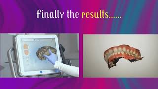 DIGITAL IMPRESSION MAKING