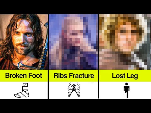 The Lord of the Rings Actors Who Got LIFELONG Disabilities from Filming
