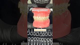 Braces Choices: Wild Smiles, Gold, Metal, Clear, or Invisalign? 🦷
