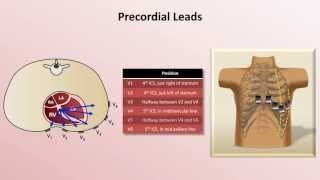 Intro to EKG Interpretation - EKG Leads