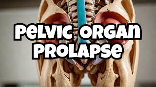 96. Pelvic Organ Prolapse | OBGYN for USMLE Step 2 CK | Types, Diagnosis & Management