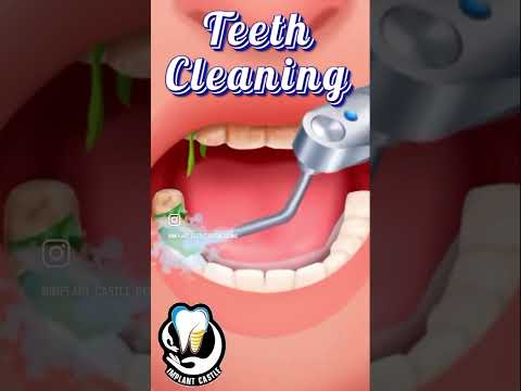 #teethcleaning #whiteteeth #bestdentistnearme #implantcastle #dentist #teethwhitening