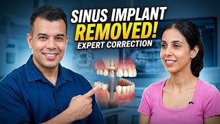 Implant in Sinus? Watch How It Was Removed & Corrected | Dr. Rajat Sachdeva, Delhi Dentist