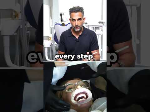 What Most Cosmetic Dentists Don't Talk About #shorts #cosmeticdentist #hollywoodsmile