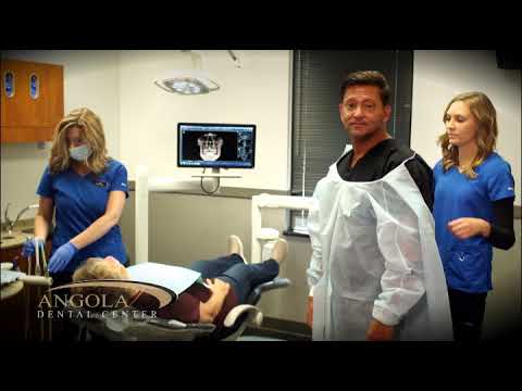 Questions About Implants | Angola