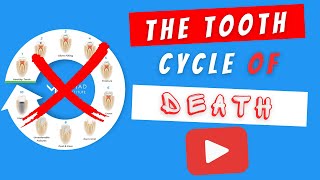 Save Teeth from Extractions & Root Canals | Biomimetic Dentistry & the "Tooth Cycle of Death"