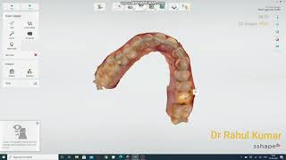 How to work on Digital Impression