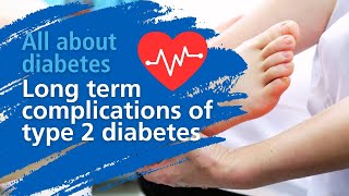 Long term complications of type 2 diabetes