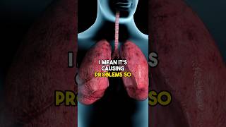 Is vaping a safe alternative to traditional cigarettes? #doctor #medicine #healthcare #healthtips