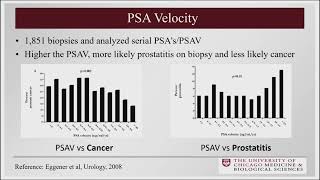 AUA Guidelines on Early Detection of Prostate Cancer Webcast (2025)