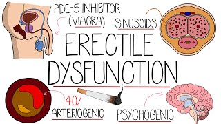 Erectile Dysfunction Explained - It's Not That Hard