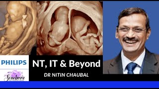 NT, IT & BEYOND | DR NITIN CHAUBAL | SONOBUZZ VIRTUAL | PHILIPS WORKSHOP