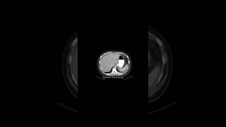 Google Gemini 2.0:Medical diagnostic with AI #aidiagnostics