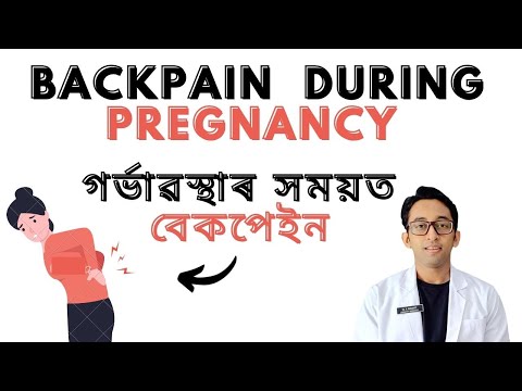 BACKPAIN DURING PREGNANCY . TIPS TO PREVENT BACKPAIN DURING PREGNANCY. DOCTOR NISHANT