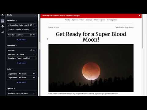 Contextual Editing in Arc XP PageBuilder