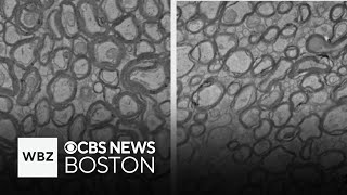 Harvard Medical School Alzheimer's research finds lithium improves memory in mice