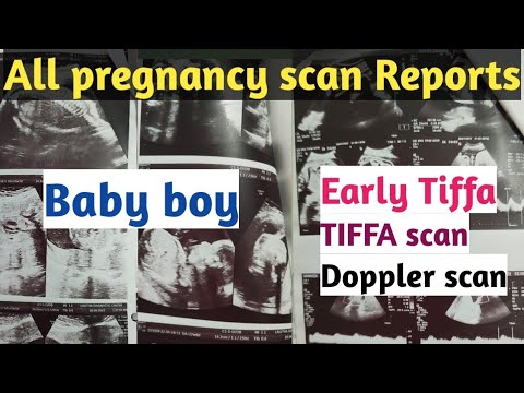All pregnancy scan reports of my baby boy|| early tiffa scan ,tiffa,Doppler scan reports || #Tiffa