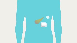 Omnipod® - Basal & Bolus Therapy