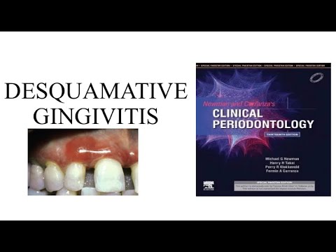 Desquamative Gingivitis lecture from Carranza