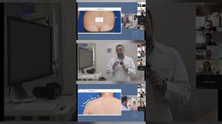 #shorts #dermatologista #dermatoscopia #dermatoscópio #mapeamentocorporal #dermatoscopiadigital