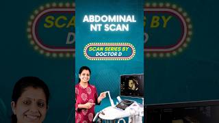Abdominal NT Scan Explained #shorts #pregnancyscan #pregnant