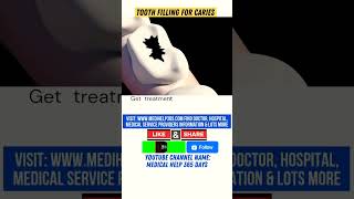 Tooth Filling- Save Tooth #shortsvideo #viral #shorts #healthtips #health #cariesdental
