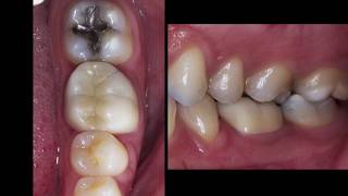 Case of the Week: Make a Good (Digital) Impression